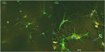 Acellular Extracellular Matrix Bioscaffolds for Cardiac Repair and Regeneration